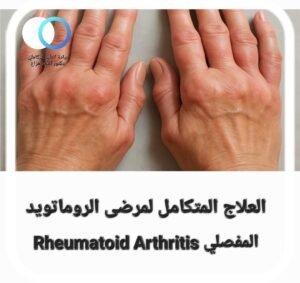 علاج الروماتويد المفصلي