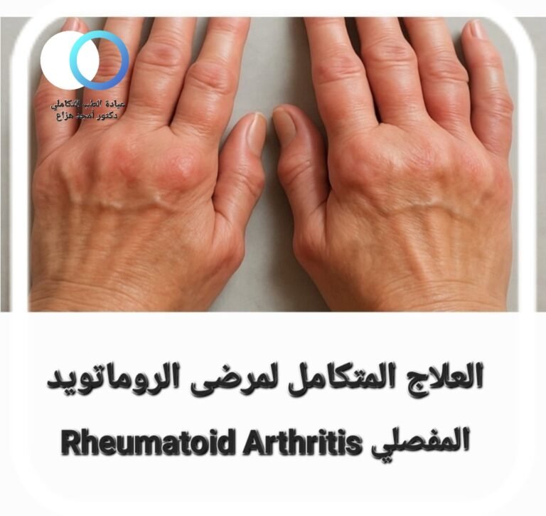 علاج الروماتويد المفصلي
