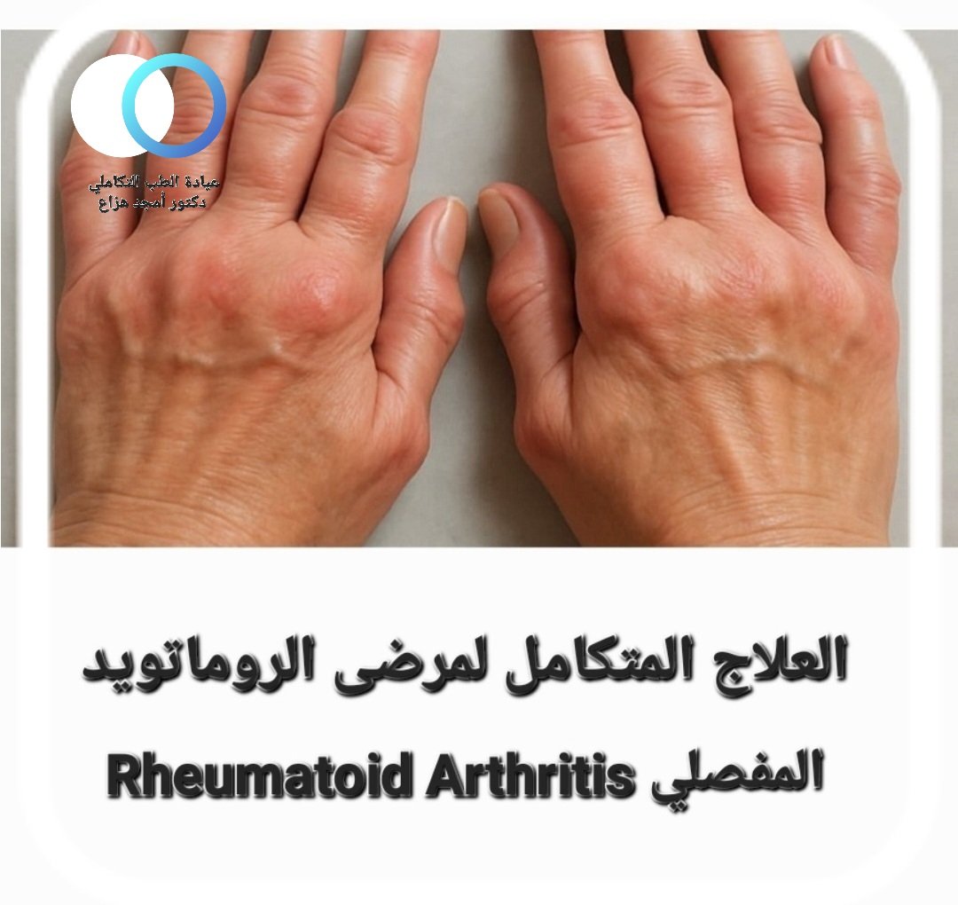 علاج الروماتويد المفصلي