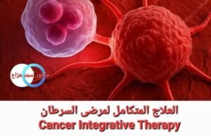 علاج السرطان